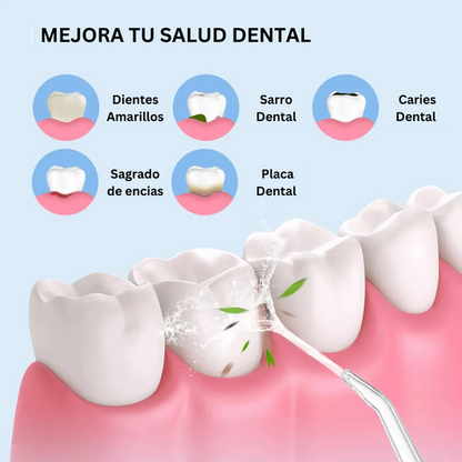 Irrigador bucal EasyClean™️ Limpieza profunda